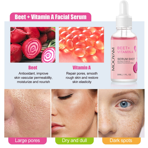 سرم مغذی چغندر قرمز و ویتامین A مویام